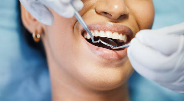 Best Broken or Chipped Tooth Repair in East Meadow, NY